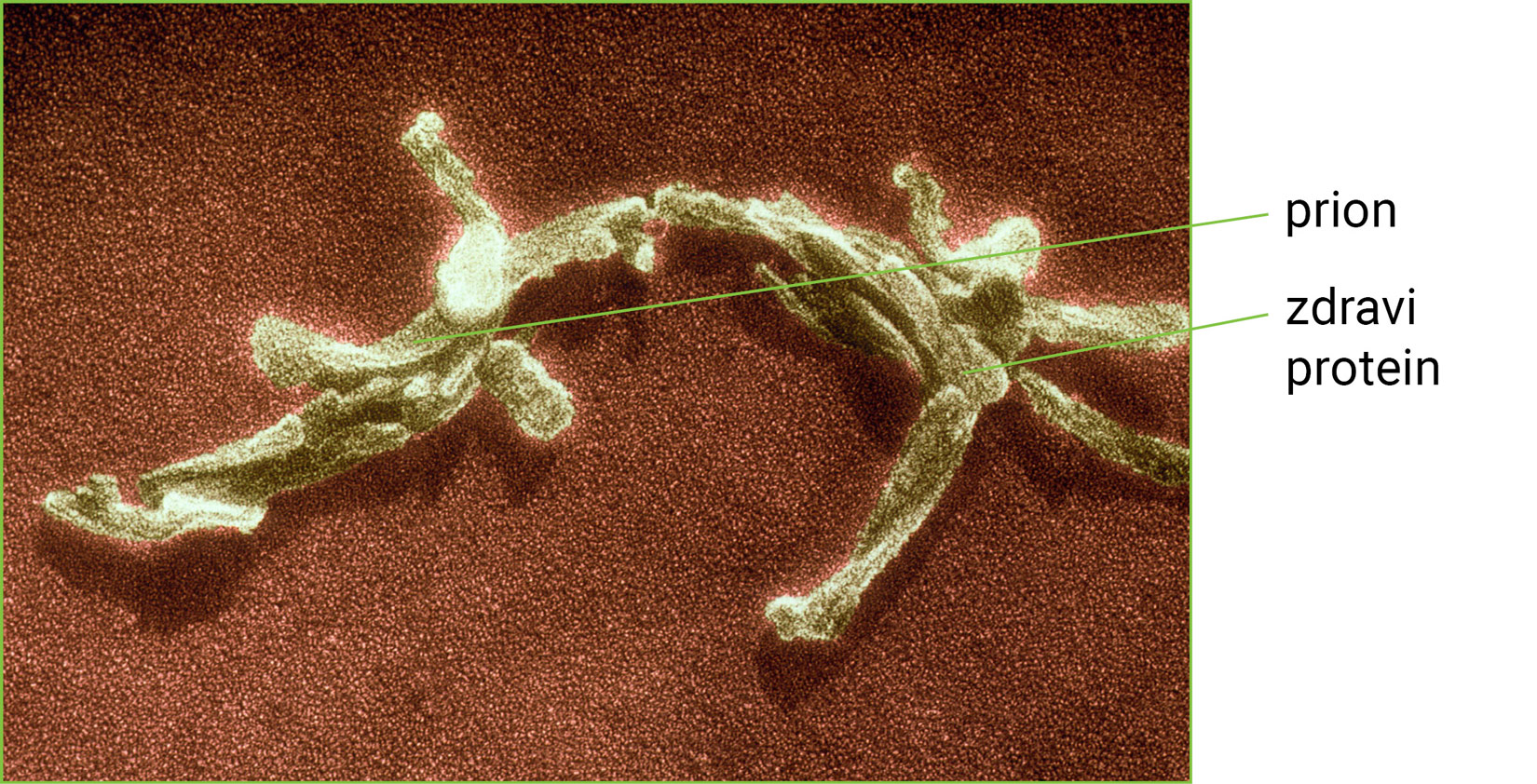 Prion pričvršćen za zdravi protein čiju će strukturu presložiti