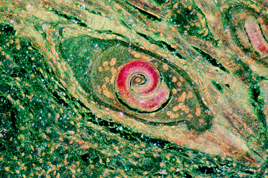 Zavojita trihina