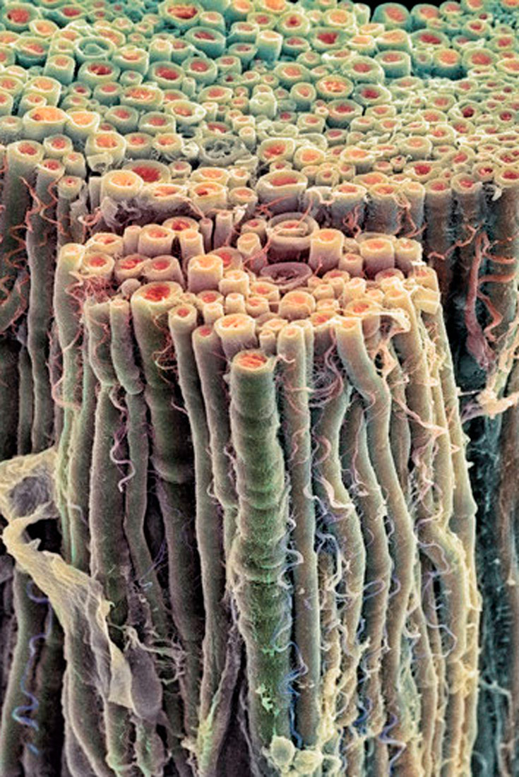 Slika prikazuje uvećani presjek živca. Izgleda poput jako puno zajedno stisnutog granja zelenkaste boje s crvenom unutrašnjosti.