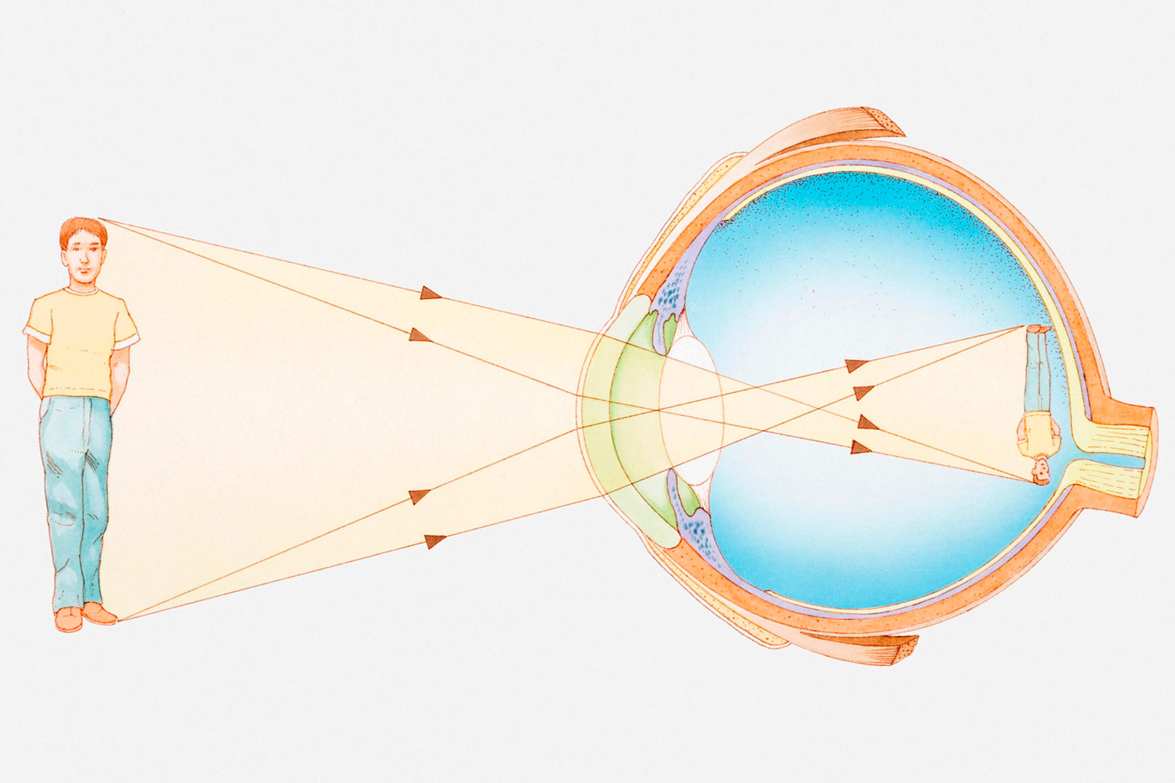 Prikazan je nastanak slike u oku. Vidi se dječak ispred velikog prikaza oka, oko obuhvaća cijelog dječaka, i kroz leću slika ulazi i pada na žutu pjegu umanjena i okrenuta naopako.