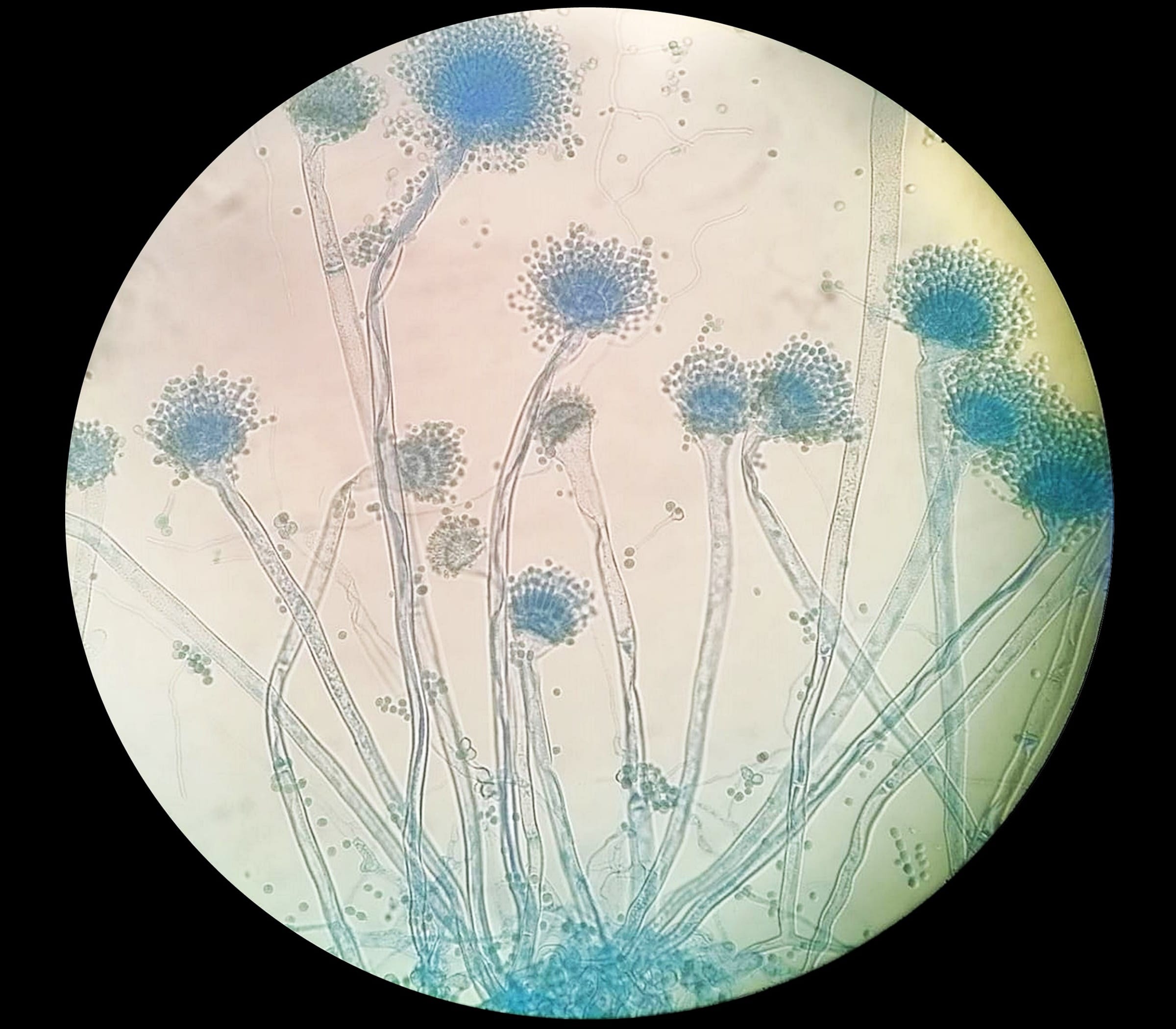 Aspergillus oryzae