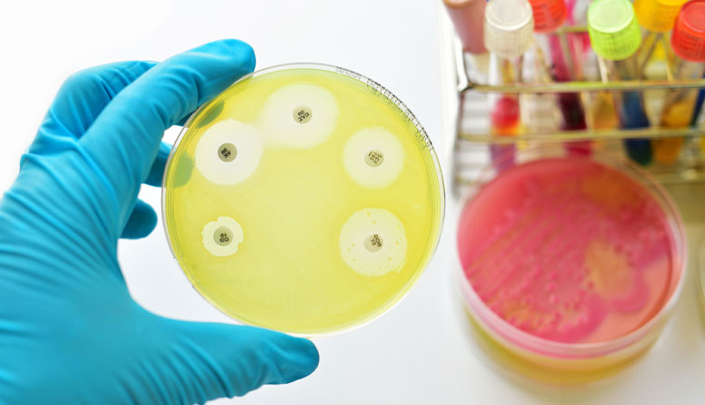 Fotografija prikazuje antibiogram.