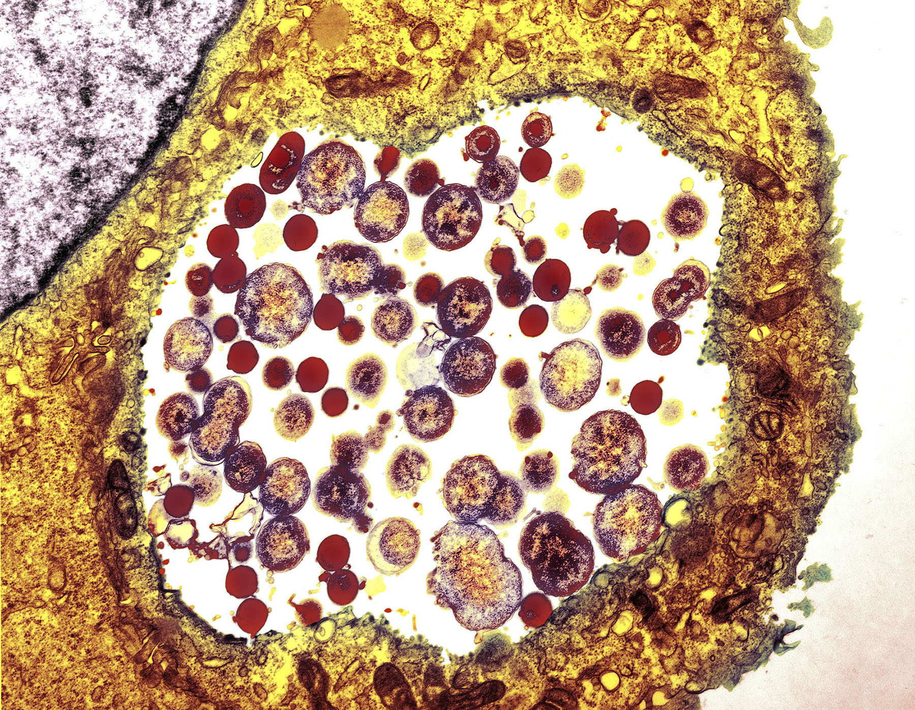 Хламидия trachomatis. Хламидия трахоматис под микроскопом. Хламидии под микроскопом.