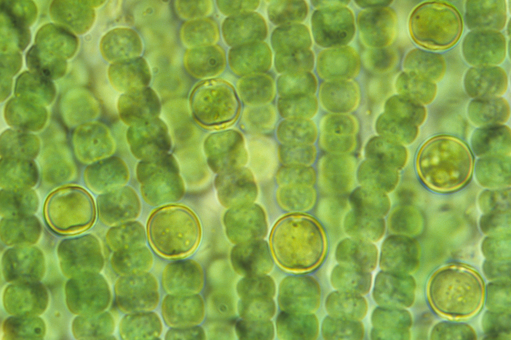 Cijanobakterija (povećanje 400X)