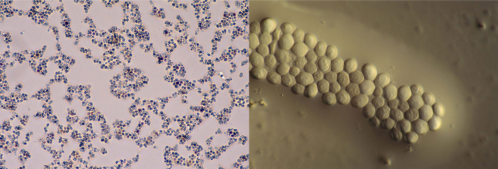 Slika 2. Pekarski kvasac promatran mikroskopom.
