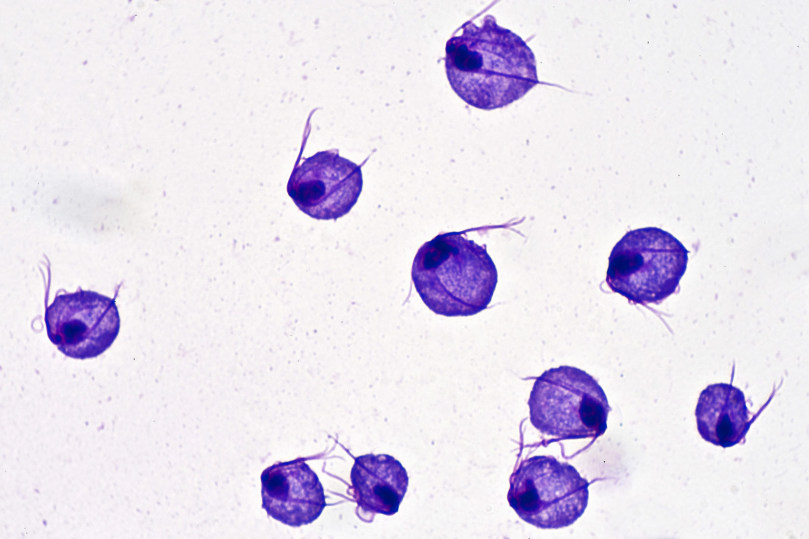 Slika prikazuje Trihomonas na bijeloj podlozi u obliku ljubičastih krugova. Oko svakog ljubičastog kruga nalaze se po dva ljubičasta nastavka.