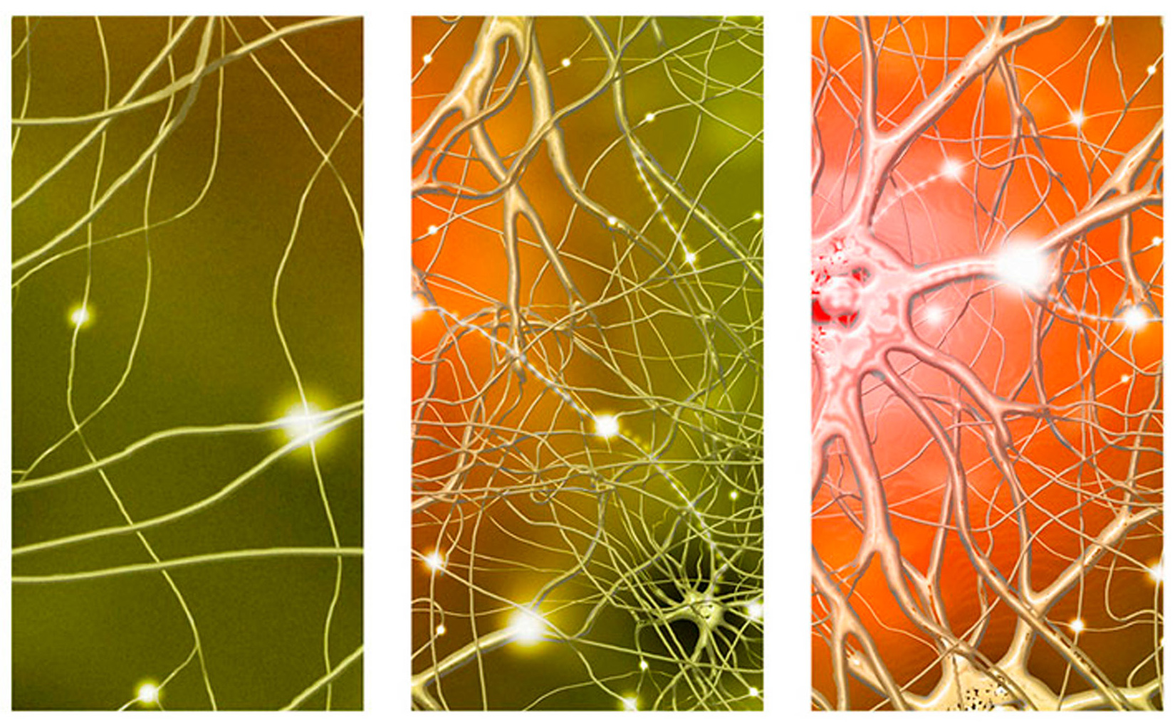 Prikazana je slika u tri etape. U prvoj etapi je manje veza između živčanih stanica, u drugoj etapi je jako puno veza, a u trećoj još više.