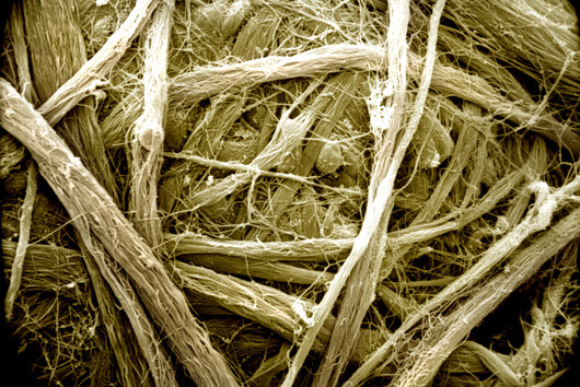 Vezivno tkivo prožeto vlaknima kolagena snimano elektronskim mikroksopom (x1840).