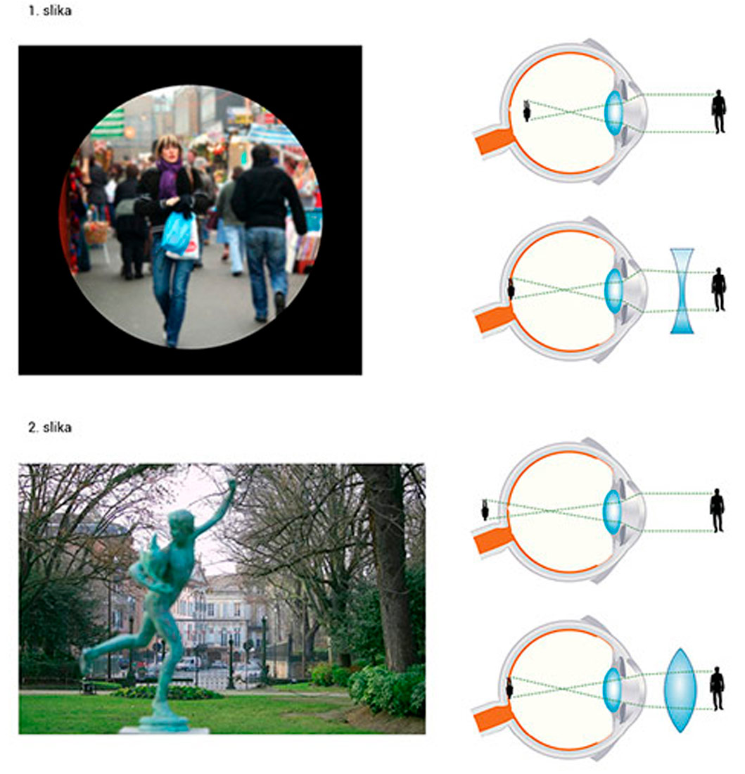 Kratkovidna i dalekovidna osoba