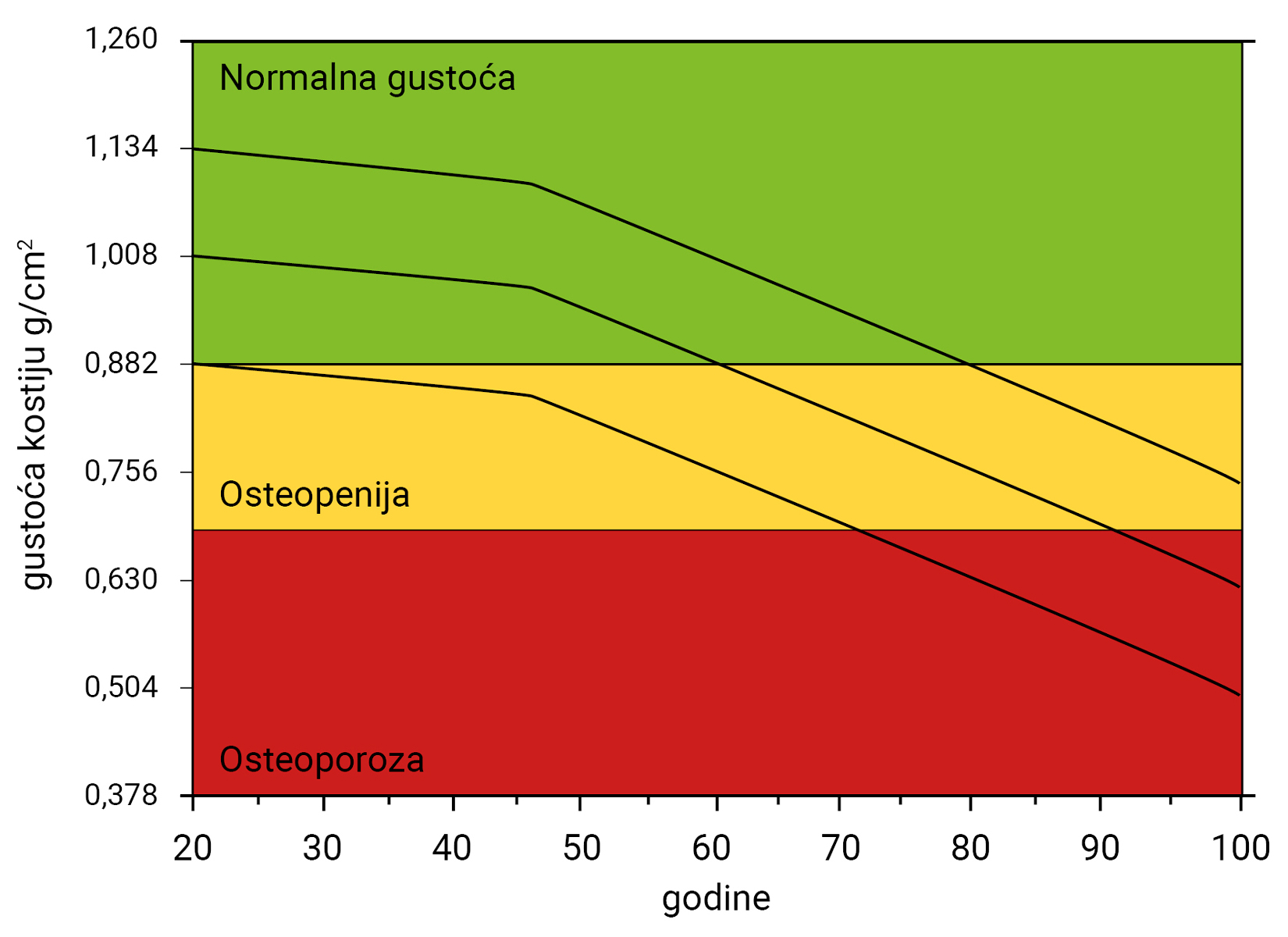 Slika 11. Prikazan je graf s promjenama u gustoći tijekom godina. Normalna gustoća ima od 0,882 do 1,260 grama po centimetru kvadratnom. Osteopenija od 0,740 do 0,882 grama po centimetru kvadratnom. Osteoporoza ima od 0,378 do 0,740
