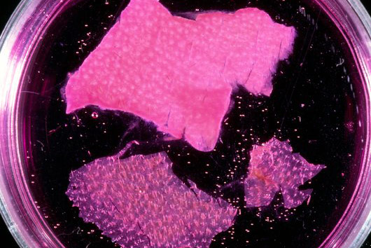 Uzgoj ljudske kože na hranjivoj podlozi