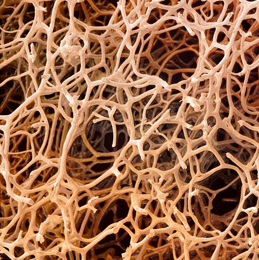 Slika prikazuje niti spongina. Sastoji se od vrlo velikog broja isprepletenih končića bijelo-sive boje koji čine gustu mrežu.
