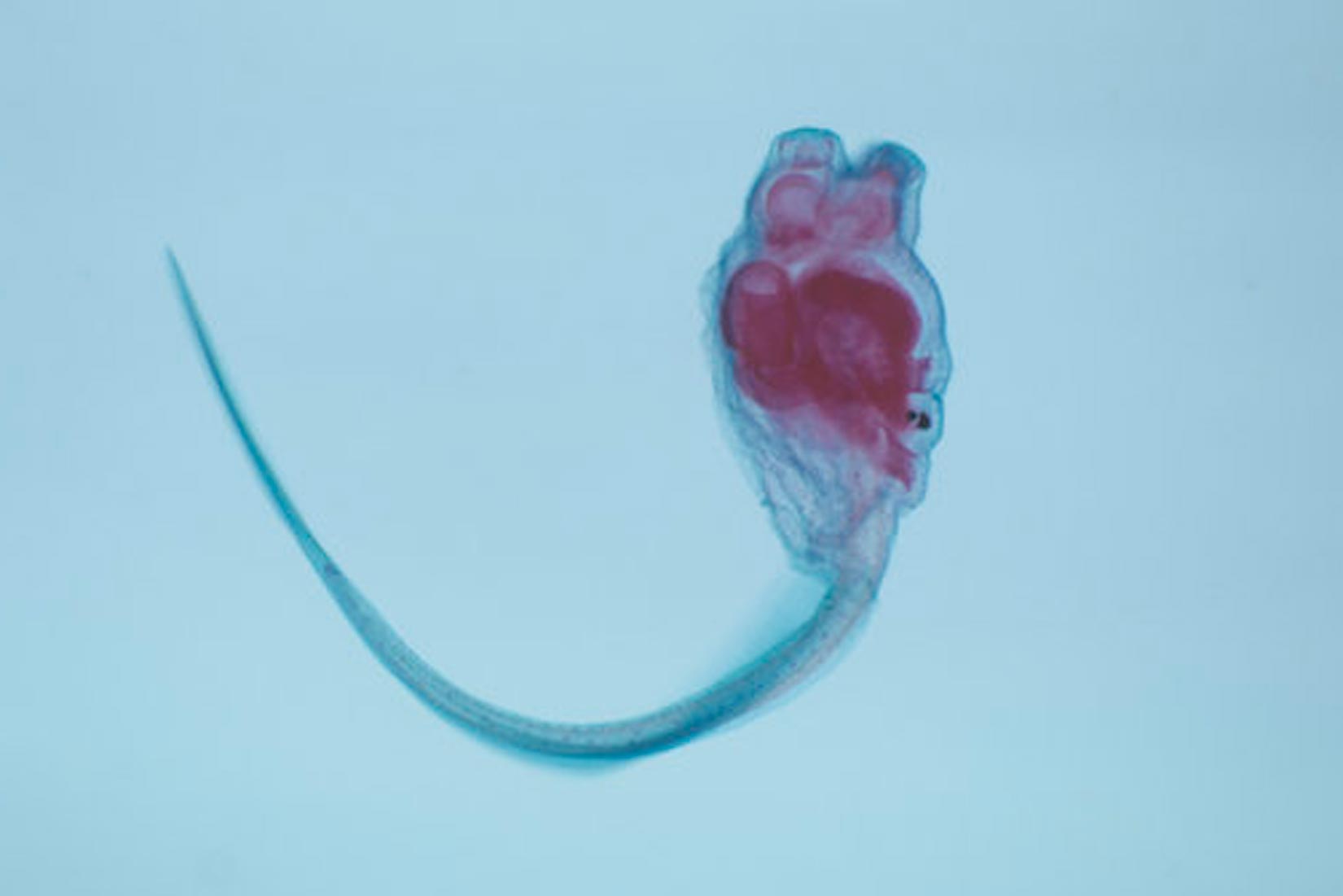 Na slici se nalazi ličinka plaštenjaka koja podsjeća na spermij s dugim repićem i kvrgavom glavom unutar koje se nalazi tamno-crvena masa.